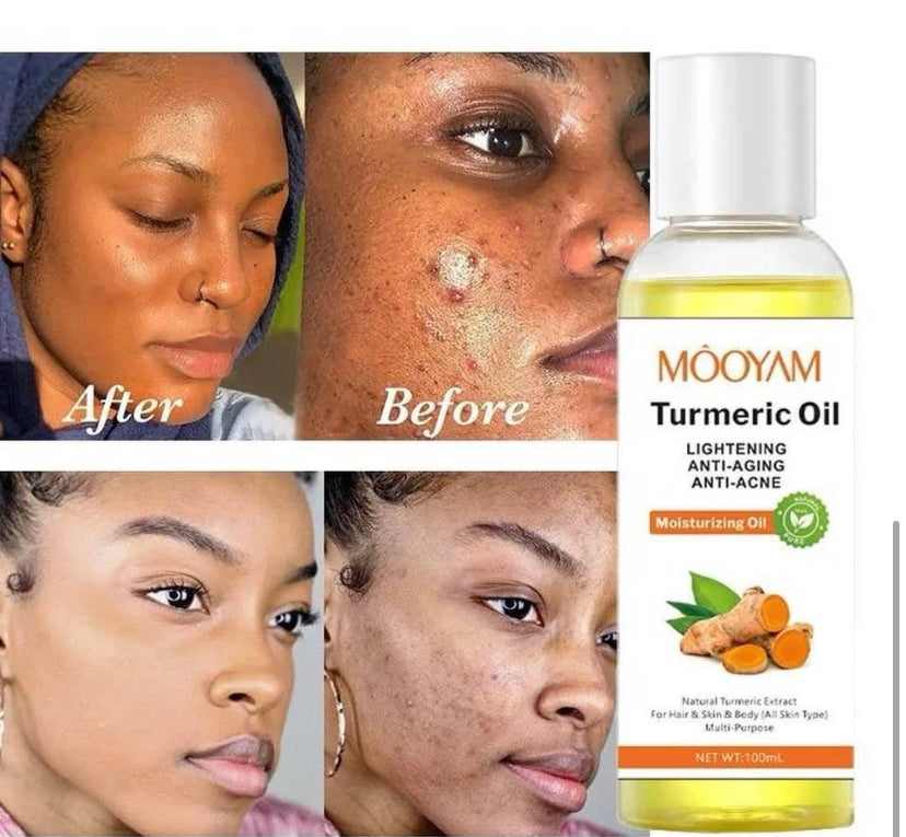 Turmeric Moisturizing Body Oil