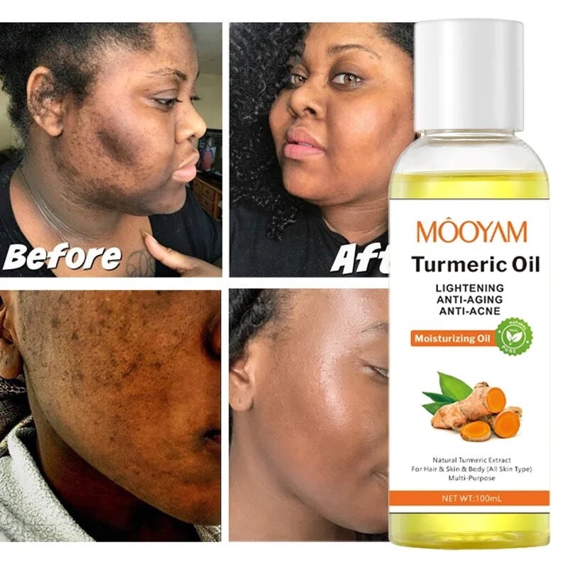 Turmeric Moisturizing Body Oil
