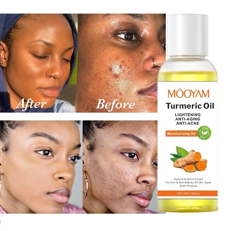 Turmeric Moisturizing Body Oil