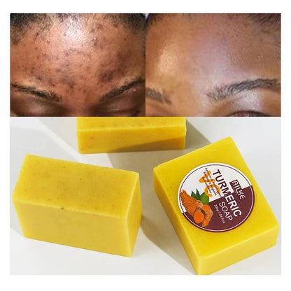 Turmeric Face Soap