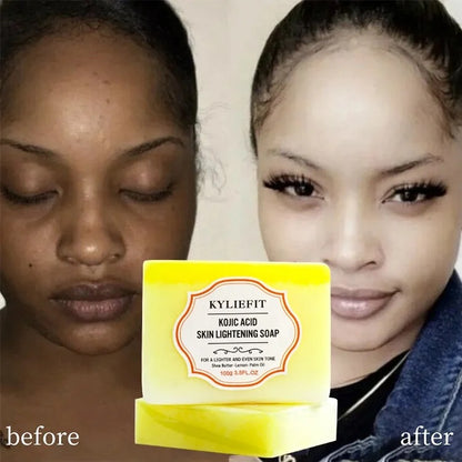 Kojic Acid Skin Lightening Soap