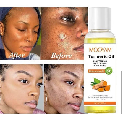 Turmeric Moisturizing Body Oil