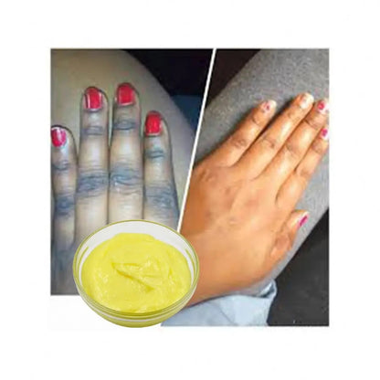 Black Knuckle Removal Cream