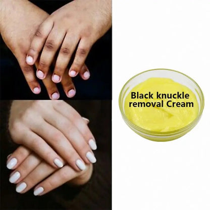 Black Knuckle Removal Cream