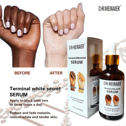 Dark Knuckle elbows and knees Serum