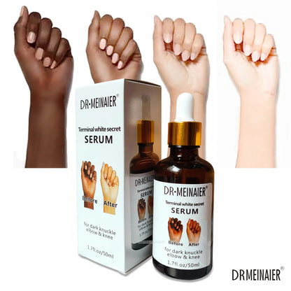 Dark Knuckle elbows and knees Serum