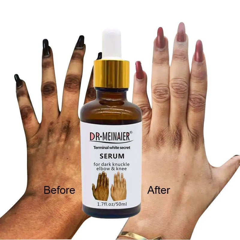 Dark Knuckle elbows and knees Serum