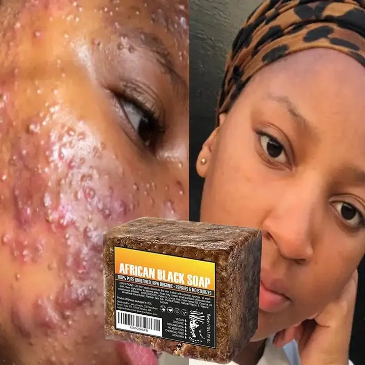 Natural Organic African Black Soap 3 for $15