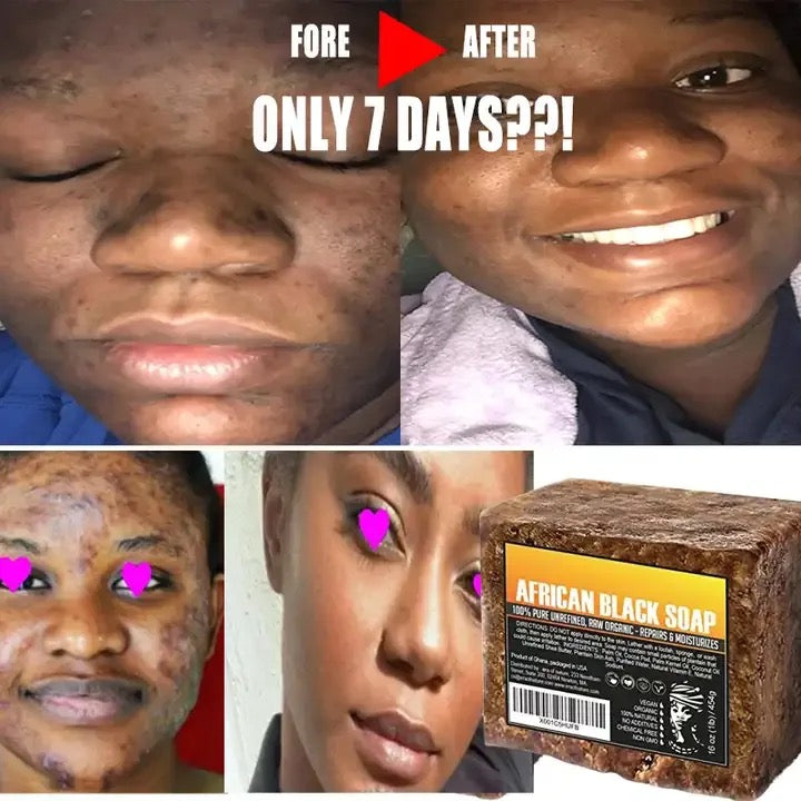 Natural Organic African Black Soap 3 for $15