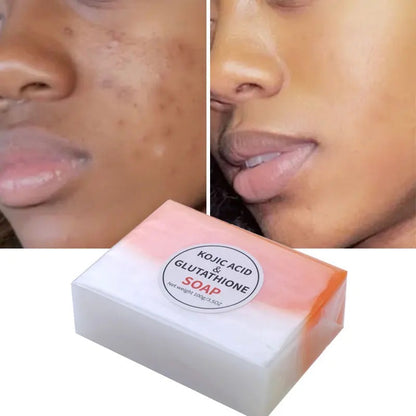 Kojic Acid and Glutathione Soap