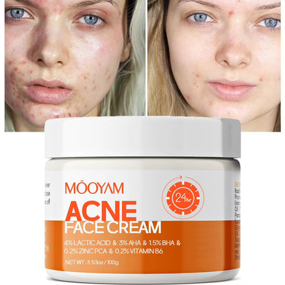 MOOYAM BUNDLE