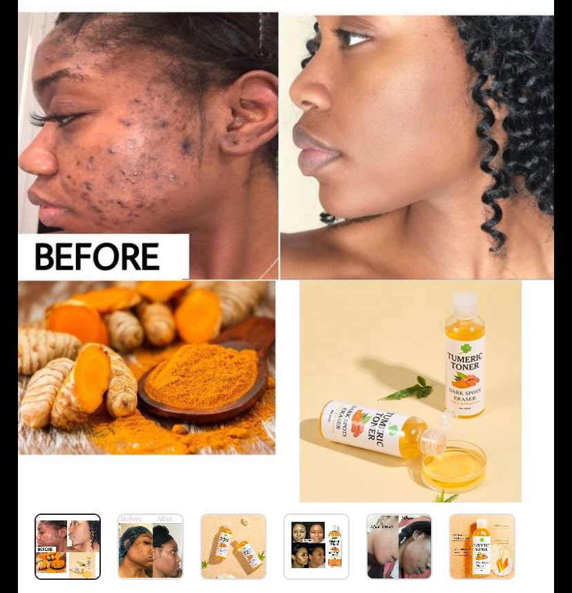 Turmeric Toner