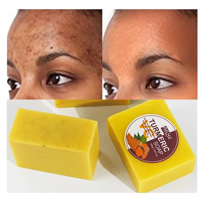 Turmeric Face Soap