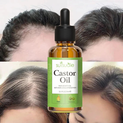 Hair And Scalp Oil