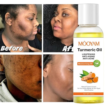 Turmeric Moisturizing Body Oil