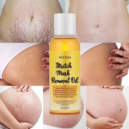 Skincare oil for stretch marks and scars