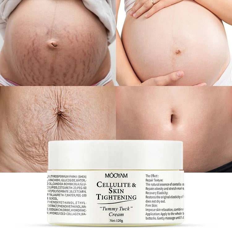 Stretch marks and Scars Cream