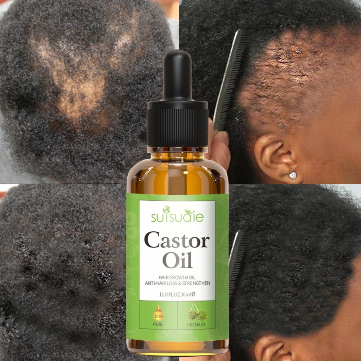 Hair And Scalp Oil