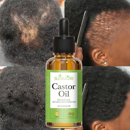 Hair And Scalp Oil