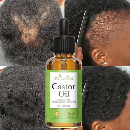 Hair And Scalp Oil