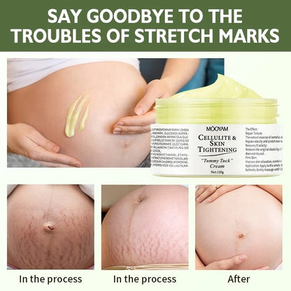 Stretch marks and Scars Cream