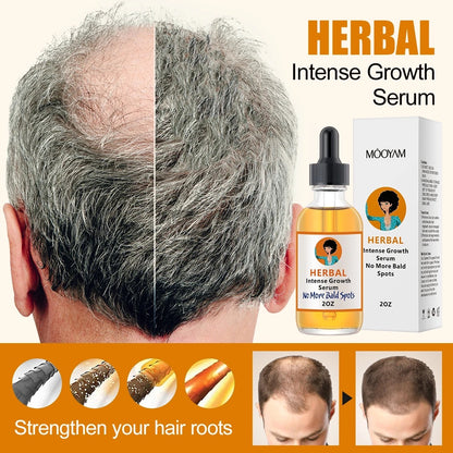 Herbal Intense Growth Serum