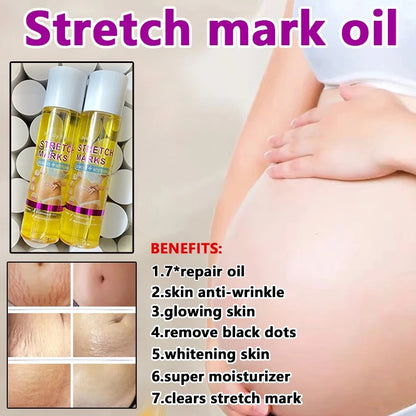 Stretch Marks Whitening Body Oli